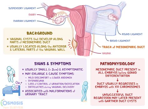 glândulas de bartholin e de skene|Skene’s Gland: Function, Location, Secretion & Conditions